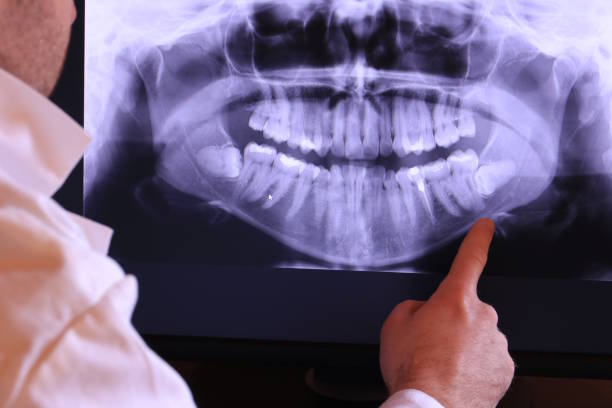 Best Cracked Tooth Emergency Dentist  in Santa Fe Springs, CA