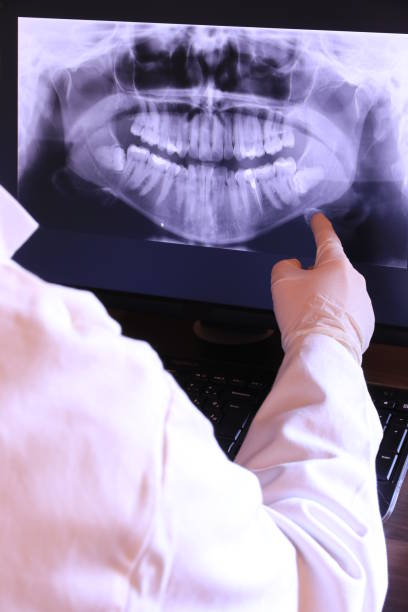 Best Root Canal Emergency Dentist  in Santa Fe Springs, CA