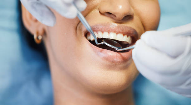 Best Dentist for Dental Trauma  in Santa Fe Springs, CA