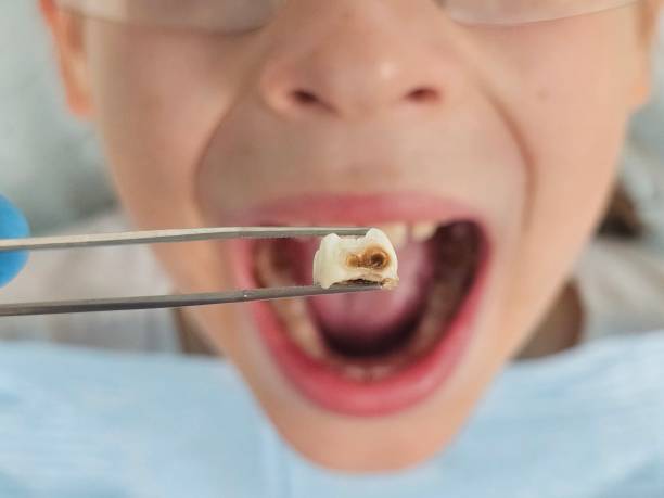 Best Emergency Gum Pain Relief  in Santa Fe Springs, CA